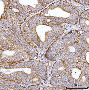BBS9 Rabbit Polyclonal Antibody