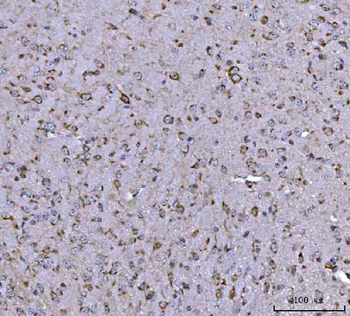 BBS9 Rabbit Polyclonal Antibody