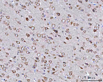BBS9 Rabbit Polyclonal Antibody