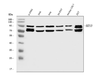 BBS9 Rabbit Polyclonal Antibody