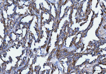 Axin 2/AXIN2 Rabbit Polyclonal Antibody