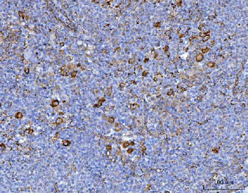 Axin 2/AXIN2 Rabbit Polyclonal Antibody