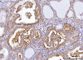 Axin 2/AXIN2 Rabbit Polyclonal Antibody