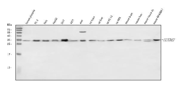 ALYREF Rabbit Polyclonal Antibody