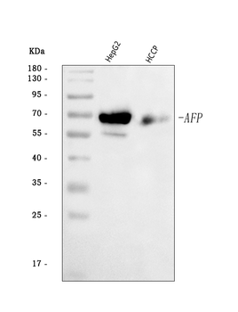 alpha 1 Fetoprotein/AFP Rabbit Polyclonal Antibody