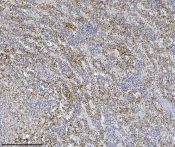 Integrin linked ILK Mouse Monoclonal Antibody