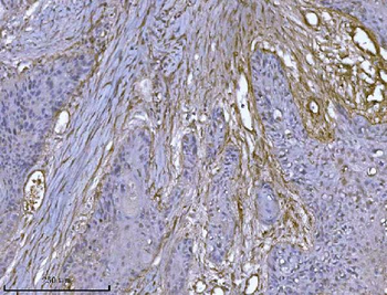 Integrin linked ILK Mouse Monoclonal Antibody