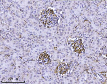 Integrin linked ILK Mouse Monoclonal Antibody