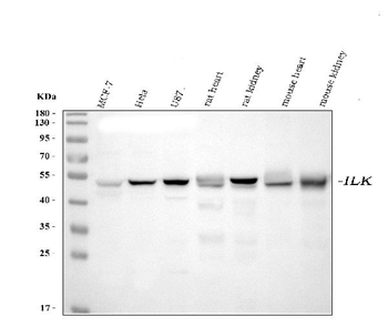 Integrin linked ILK Mouse Monoclonal Antibody
