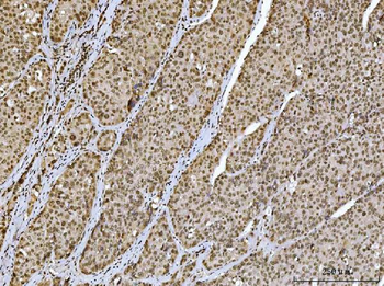 Ataxin 1 Mouse Monoclonal Antibody