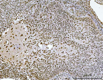 Ataxin 1 Mouse Monoclonal Antibody