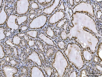 Ataxin 1 Mouse Monoclonal Antibody
