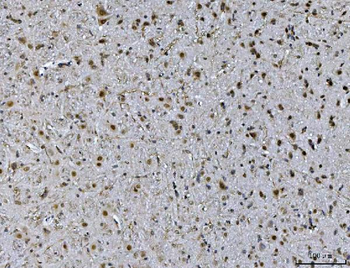 Ataxin 1 Mouse Monoclonal Antibody