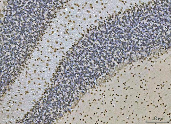 Ataxin 1 Mouse Monoclonal Antibody