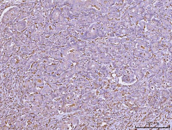 HLA-DR/HLA-DRA/HLA Mouse Monoclonal Antibody