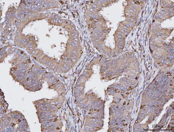 HLA-DR/HLA-DRA/HLA Mouse Monoclonal Antibody
