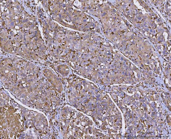 HLA-DR/HLA-DRA/HLA Mouse Monoclonal Antibody