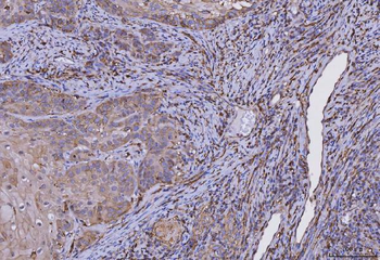 HLA-DR/HLA-DRA/HLA Mouse Monoclonal Antibody