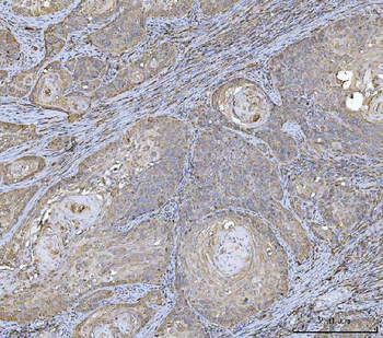HLA-DR/HLA-DRA/HLA Mouse Monoclonal Antibody