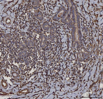 HLA-DR/HLA-DRA/HLA Mouse Monoclonal Antibody