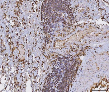 HLA-DR/HLA-DRA/HLA Mouse Monoclonal Antibody