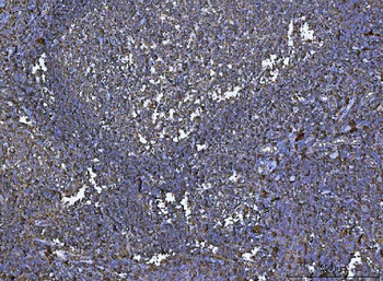 HLA-DR/HLA-DRA/HLA Mouse Monoclonal Antibody