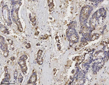 Annexin A3 Mouse Monoclonal Antibody