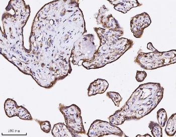 Annexin A3 Mouse Monoclonal Antibody