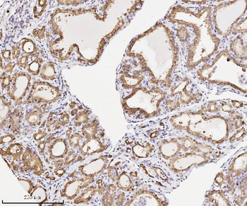 Annexin A3 Mouse Monoclonal Antibody
