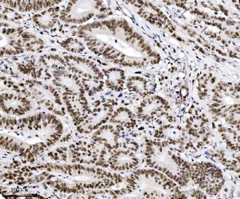 TRIM24 Mouse Monoclonal Antibody
