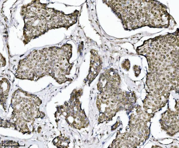 TRIM24 Mouse Monoclonal Antibody