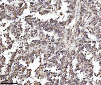 TRIM24 Mouse Monoclonal Antibody