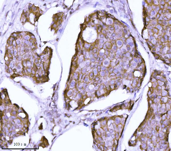 delta 1 Catenin/CAS/CTNND1 Mouse Monoclonal Antibody