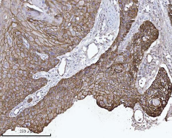 delta 1 Catenin/CAS/CTNND1 Mouse Monoclonal Antibody