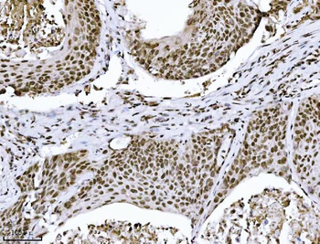 KPNB1 Mouse Monoclonal Antibody