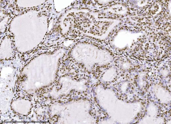 KPNB1 Mouse Monoclonal Antibody