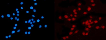KPNB1 Mouse Monoclonal Antibody