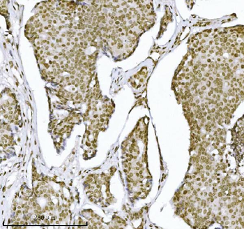 KPNB1 Mouse Monoclonal Antibody