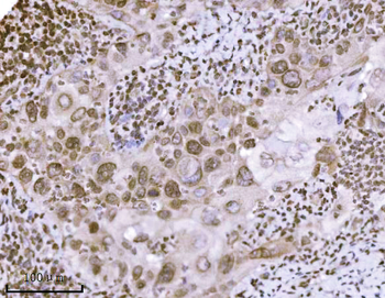 KPNB1 Mouse Monoclonal Antibody