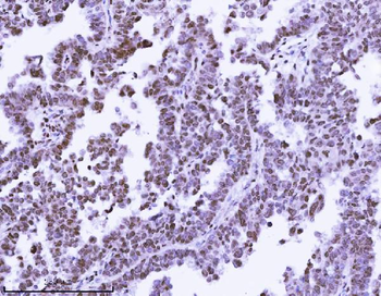 KPNB1 Mouse Monoclonal Antibody