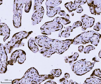 KPNB1 Mouse Monoclonal Antibody