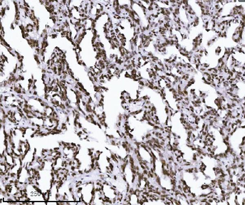 KPNB1 Mouse Monoclonal Antibody