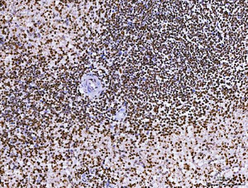 RCC1 Mouse Monoclonal Antibody