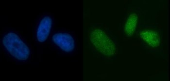 MCM7 Mouse Monoclonal Antibody