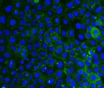 Integrin beta 4/ITGB4 Mouse Monoclonal Antibody