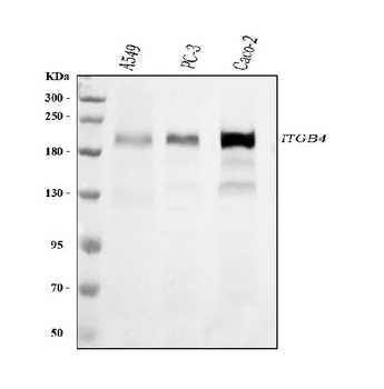 Integrin beta 4/ITGB4 Mouse Monoclonal Antibody
