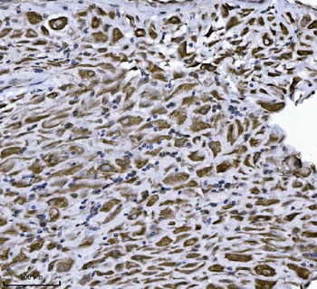 Erlin-2/ERLIN2 Mouse Monoclonal Antibody