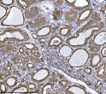Erlin-2/ERLIN2 Mouse Monoclonal Antibody