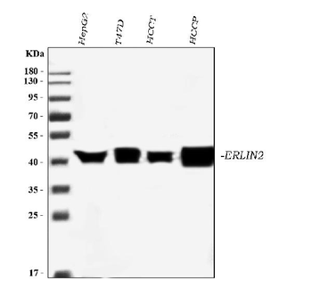 Erlin-2/ERLIN2 Mouse Monoclonal Antibody