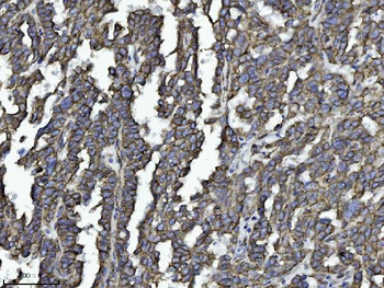 Drebrin/DBN1 Mouse Monoclonal Antibody